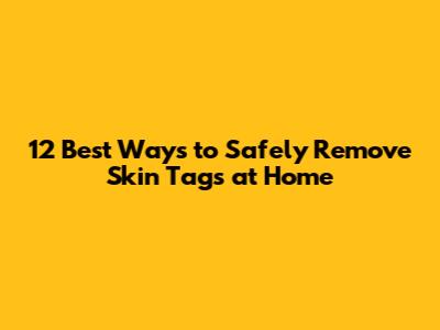 12 Best Ways to Safely Remove Skin Tags at Home